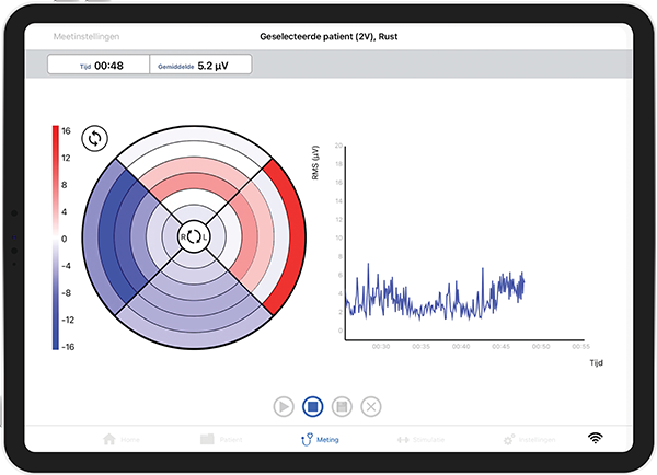 Maple Biofeedback